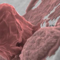 New cell culture